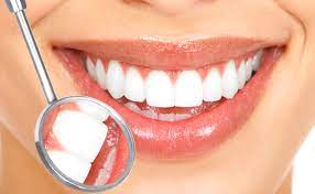 Tips for Improving Your Smile Through Natural Methods